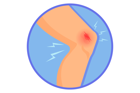 Knee Injury Graphics & Illustrations for Medical Design